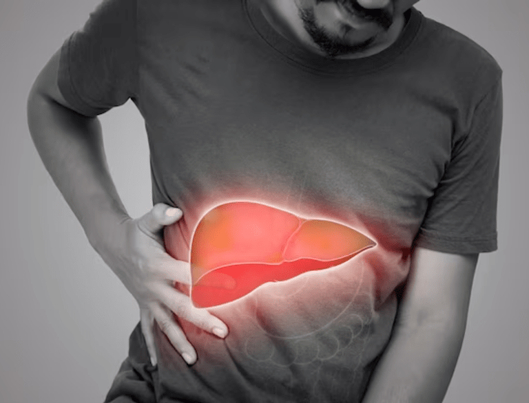 Liver Disorders