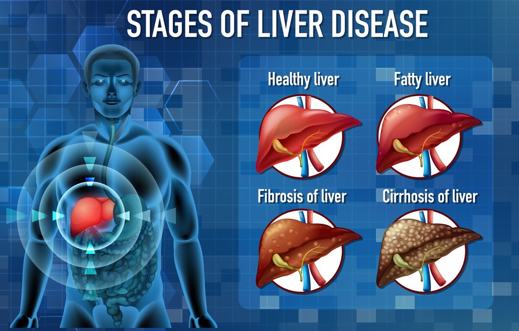 stages of liver disorder